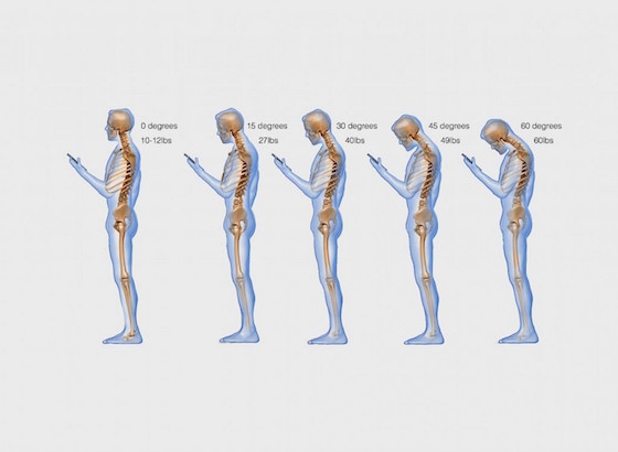 It "text neck" becoming an epidemic? Click on the link for more information on what texting can be doing to your body!